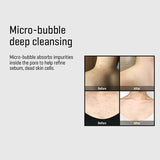 AHA-BHA-PHA 30 Days Miracle Acne Clear Body Cleanser