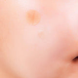 A-Clear Soothing Clear Spot Patch