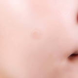 A-Clear Soothing Clear Spot Patch